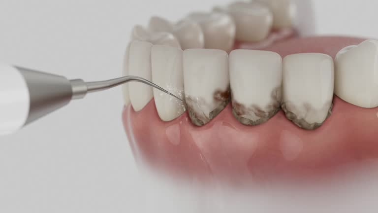 Trusted Tooth Extraction service in Baxter, TN - Dentist Open Now